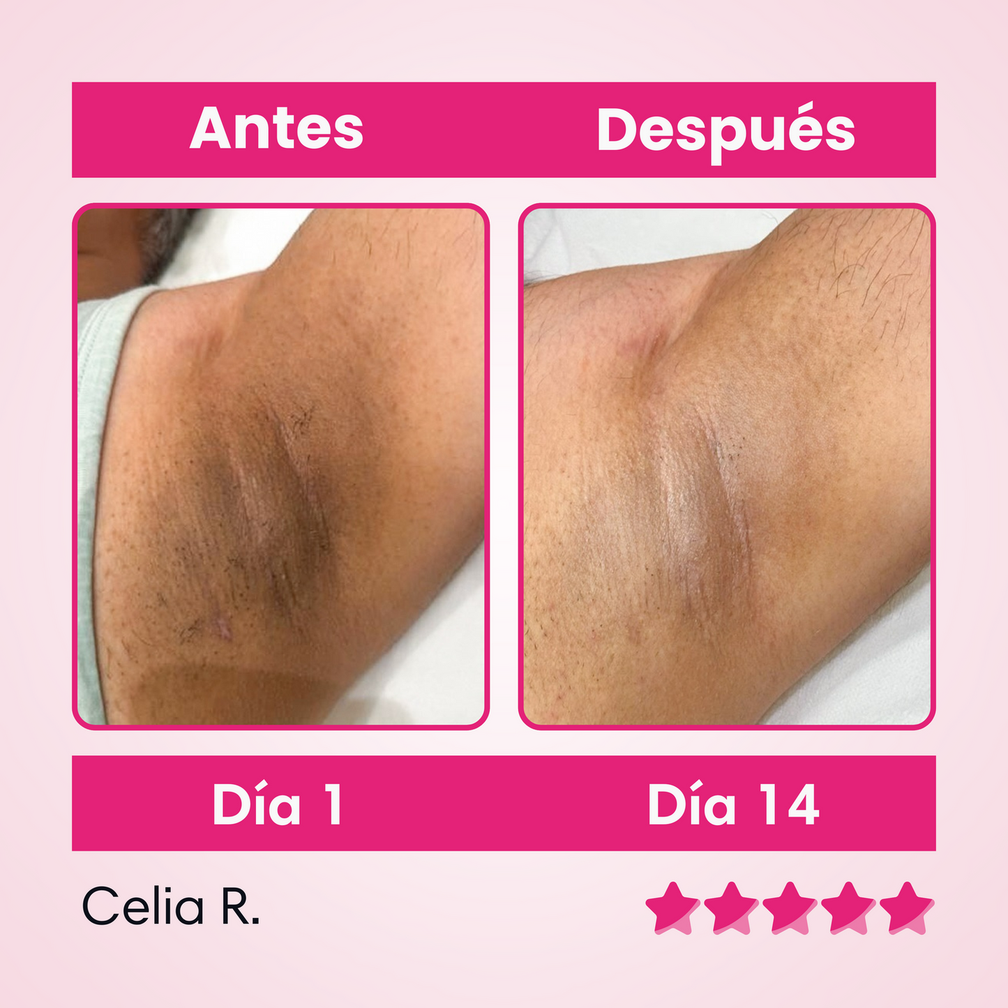 ✨ Skinglow – Crema Aclarante