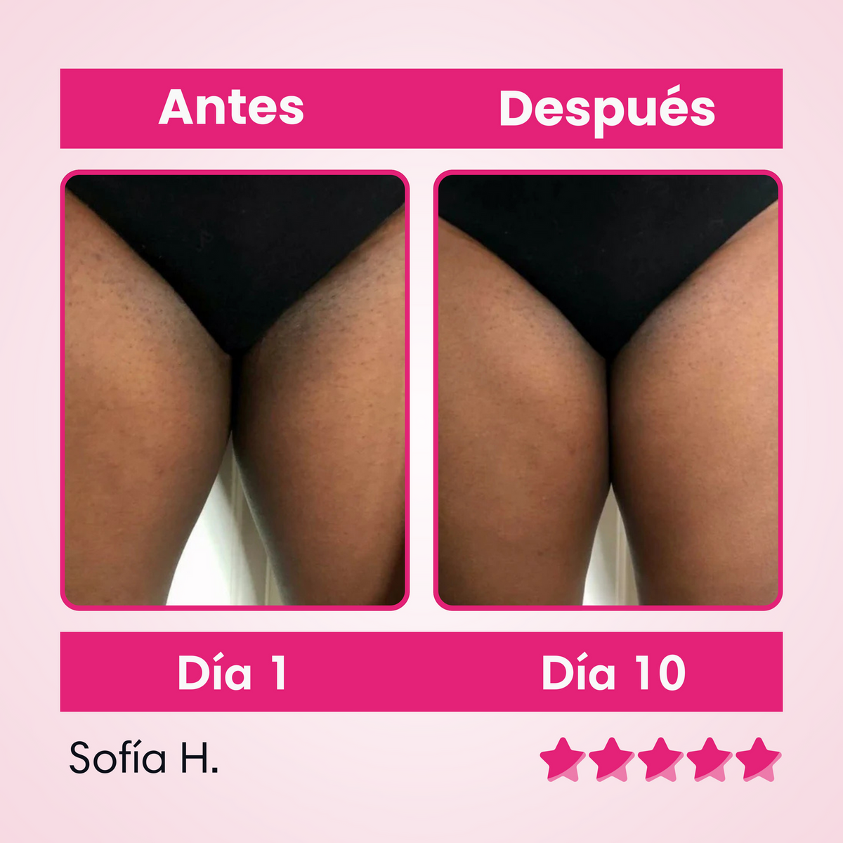 ✨ Skinglow – Crema Aclarante