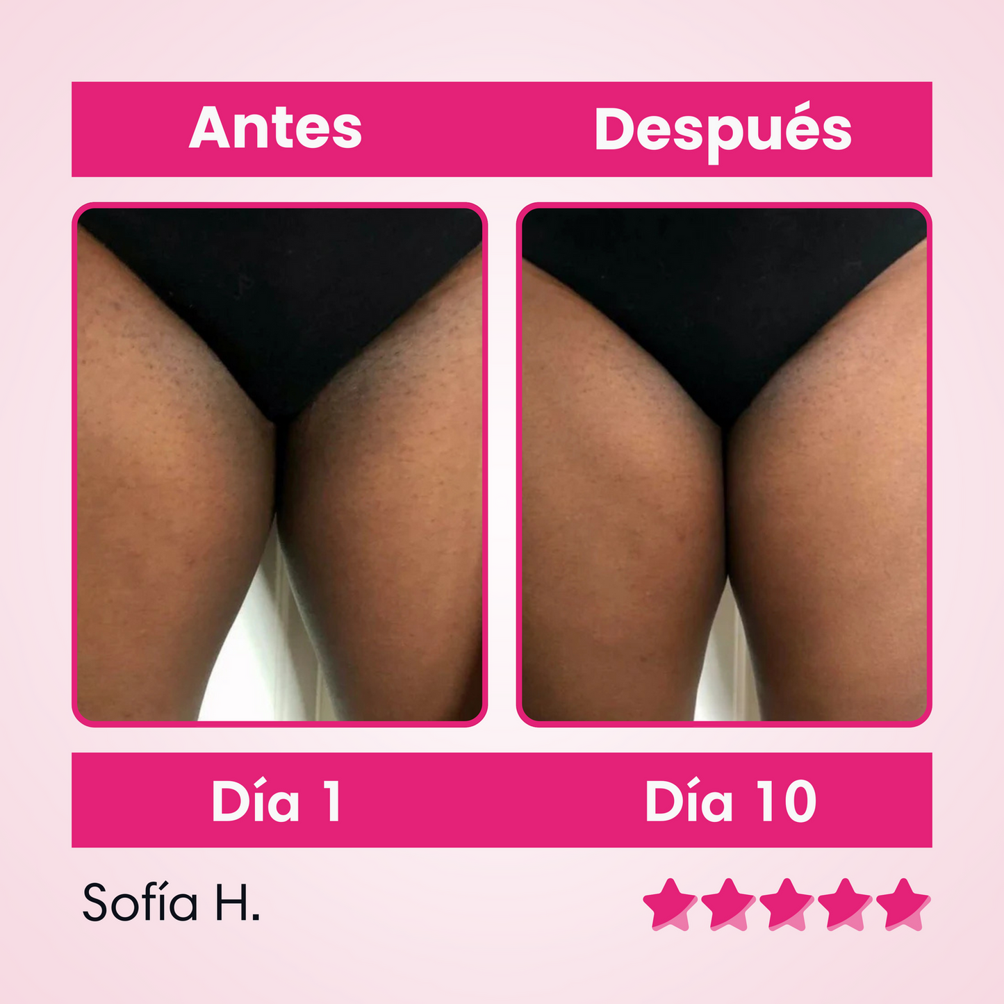 ✨ Skinglow – Crema Aclarante