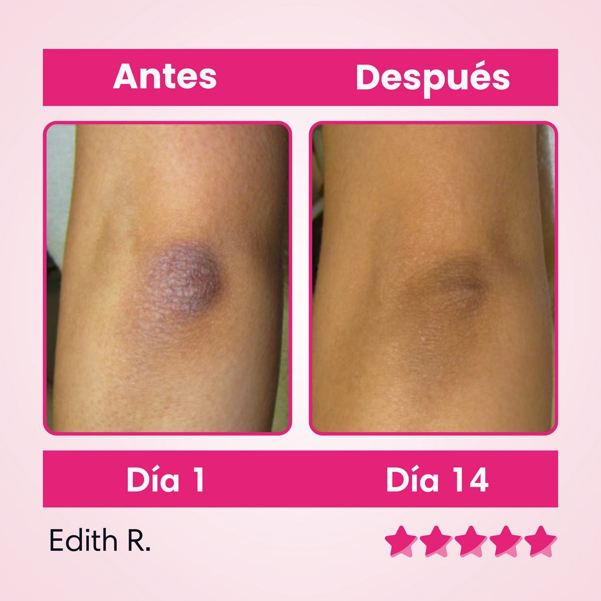 ✨ Skinglow – Crema Aclarante