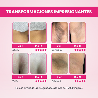 ✨ Skinglow – Crema Aclarante